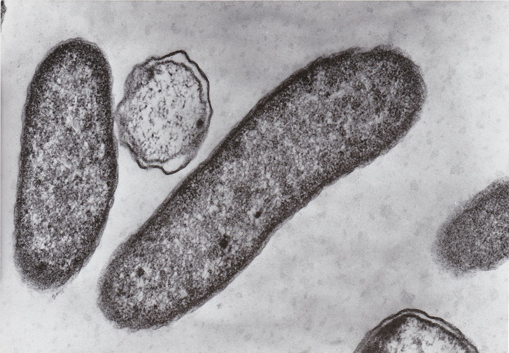 Vibrio-Infektionen werden durch Bakterien hervorgerufen. 