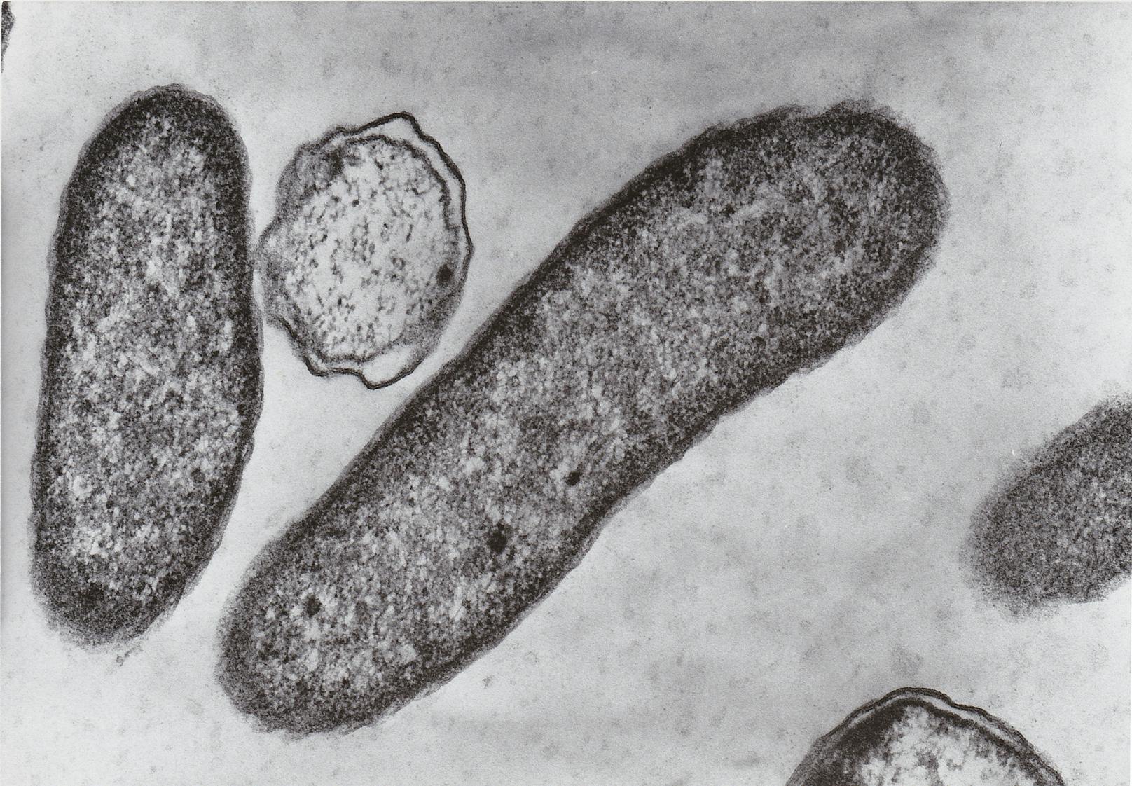 Fleischfressende Bakterien – Mann nach Bad in Ostsee tot
