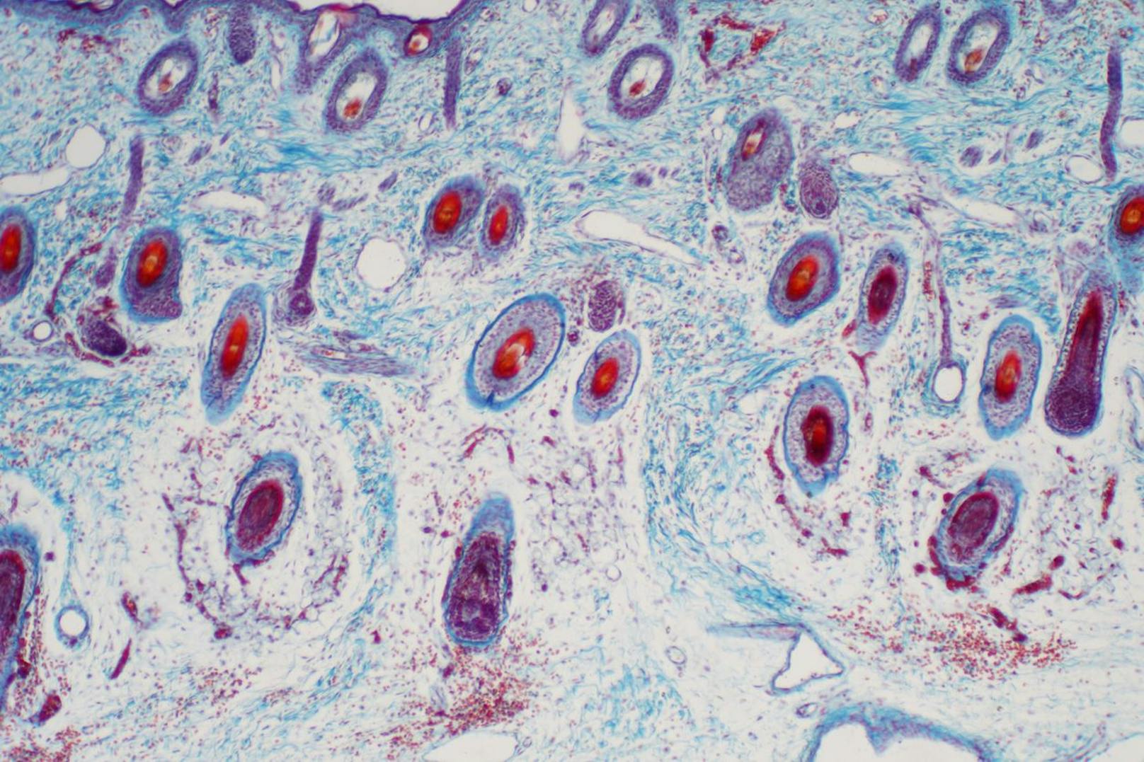 Querschnitt menschlichen Hautgewebes unter dem Mikroskop (Bild).