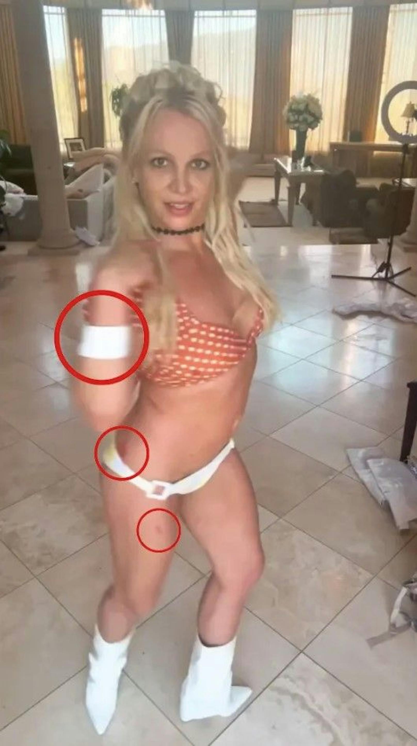 Sind diese Wunden von Britney mit ihren Messern entstanden?