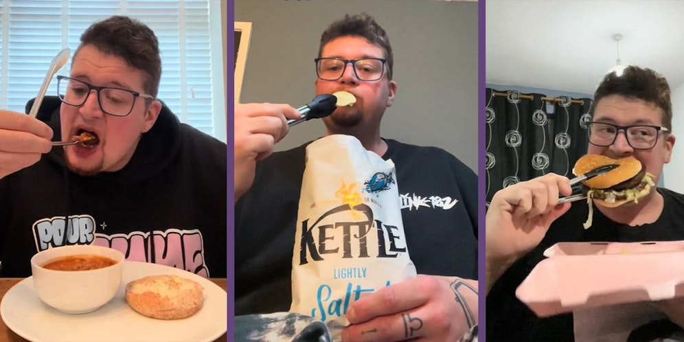 John Junior (Bild) muss alles mit einer Metallzange essen.&nbsp;