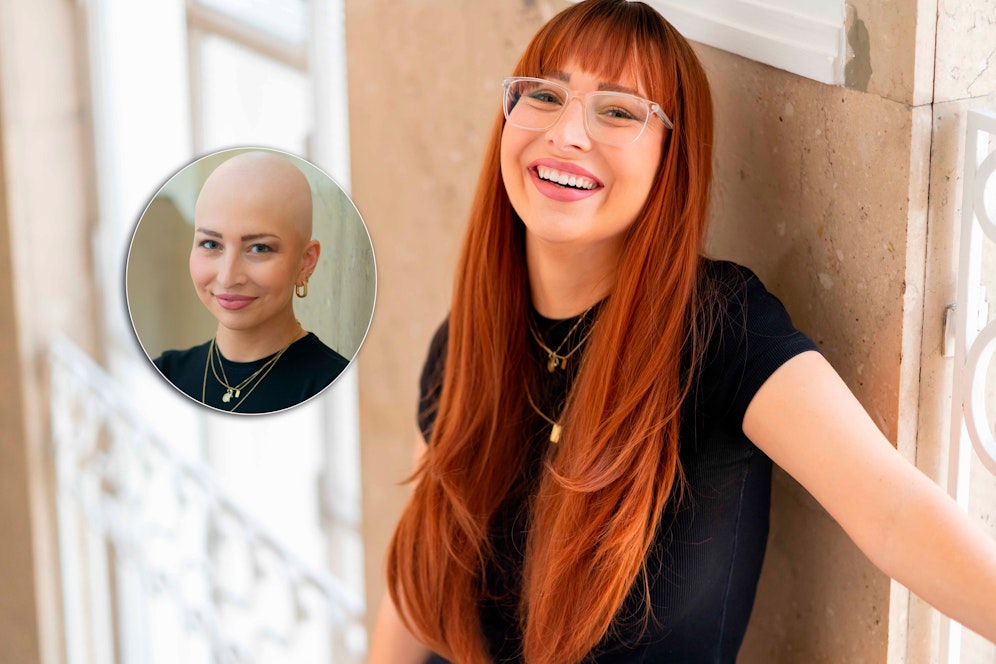 Julia S. verlor nach der Chemotherapie ihre Haare. Bei einem Workshop von 