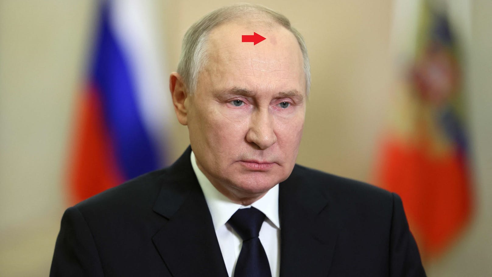Wladimir Putin und sein Fleck auf der Stirn.