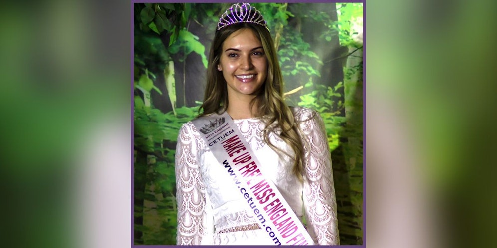 Die 26-jährige Natasha Beresford (Bild) gewann den ersten ungeschminkten Schönheitswettbewerb in Großbritannien.