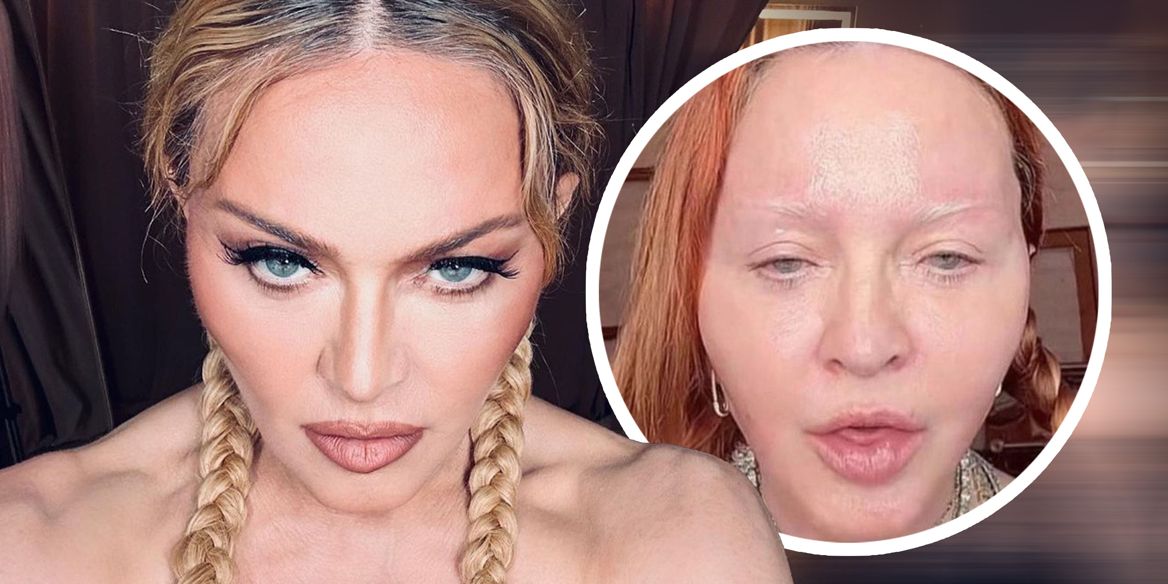 Madonna ist ohne Filter und Makeup fast nicht wiederzuerkennen.