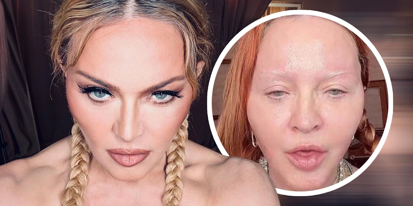Madonna ist ohne Filter und Make-up fast nicht wiederzuerkennen.