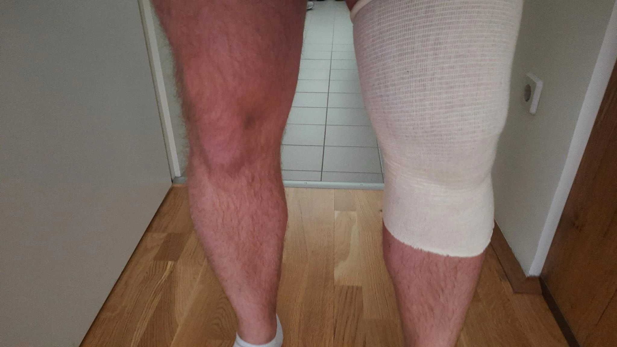 Das Knie des 32-Jährigen
