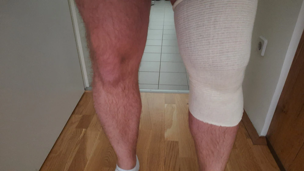 Das Knie des 32-Jährigen