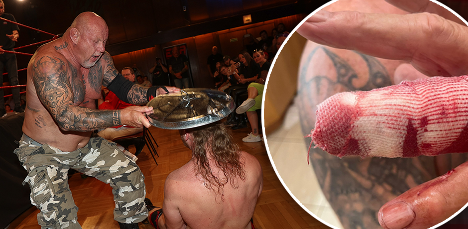 Franz Schlederer zeigt "Heute" seine Wunde