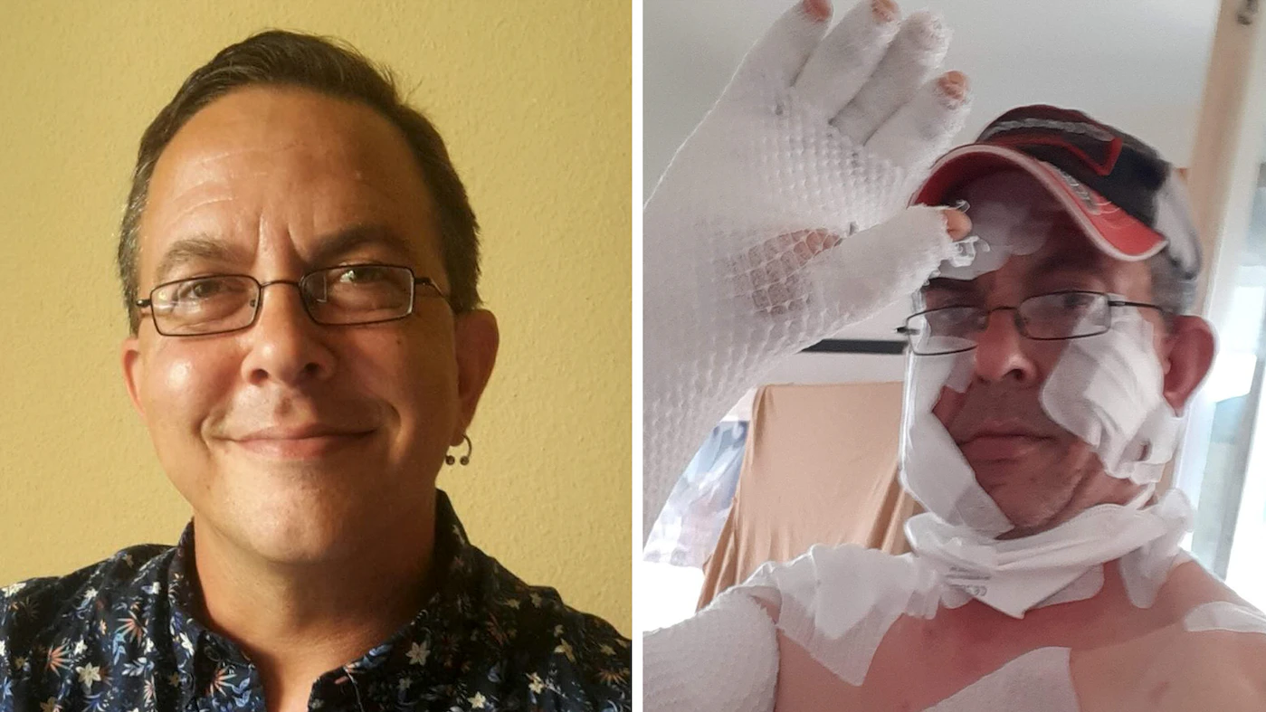 Wiener leidet nach Burnout an unheilbarer Krankheit, Norbert B.