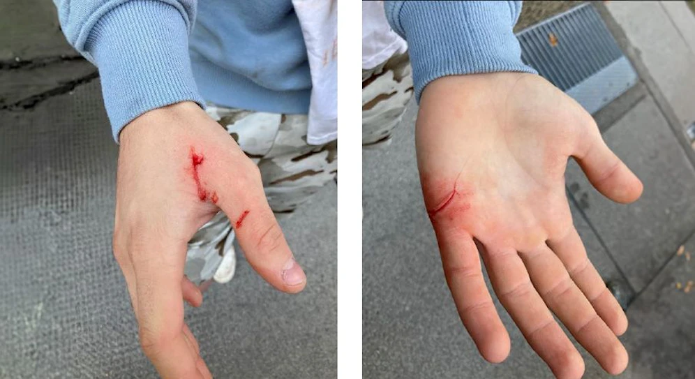 Stiefvater sticht auf 17-Jährigen ein.