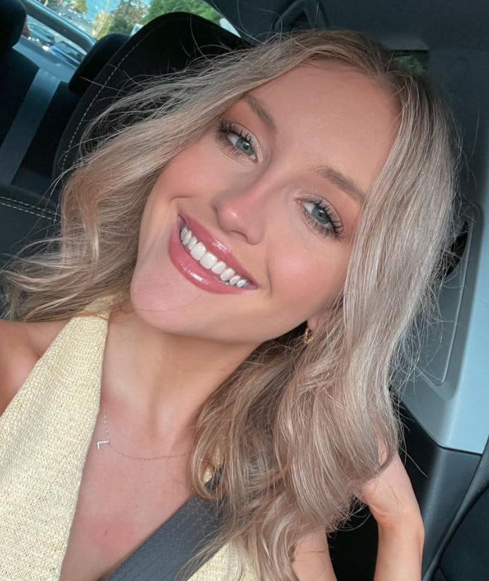 Lilie James wurde nur 21 Jahre alt.