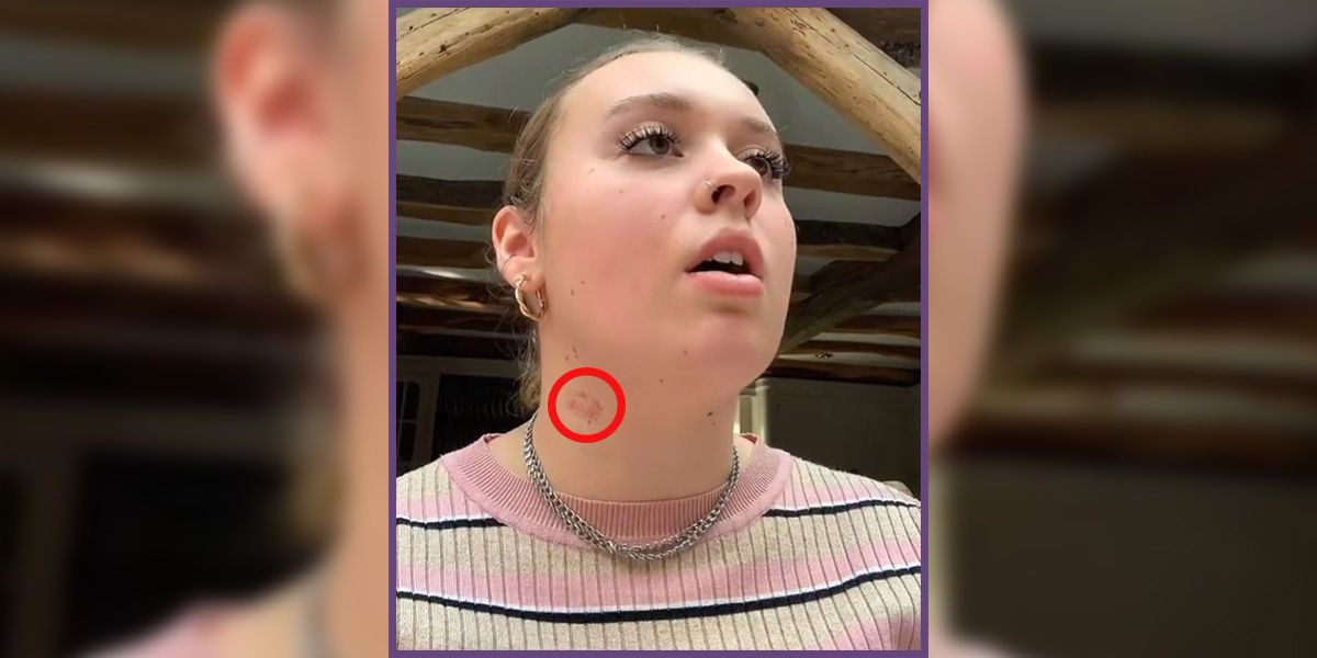 Mollie Burkitt (Bild) mit ihrem 