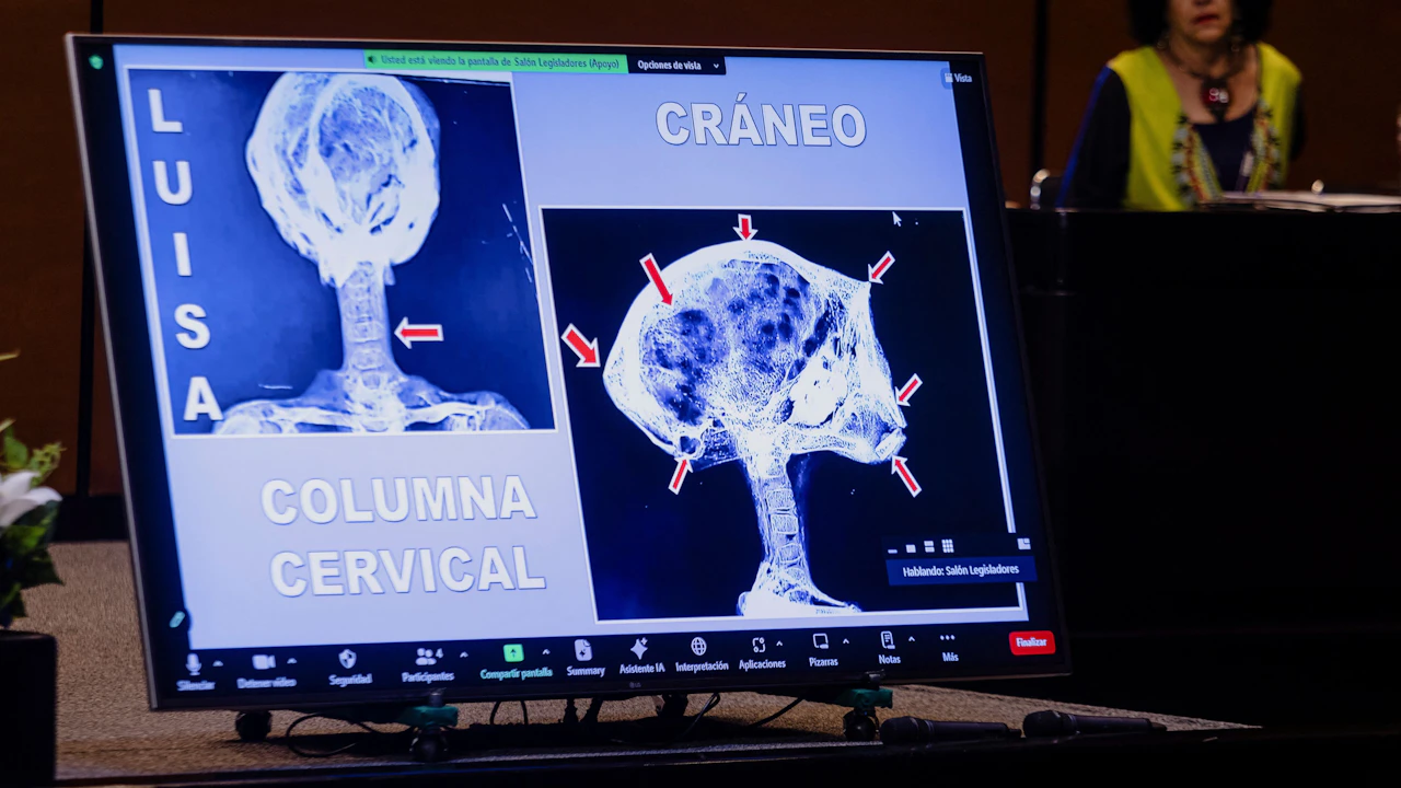 Heute.at - Ufologe zeigt angebliche Alien-Röntgenbilder