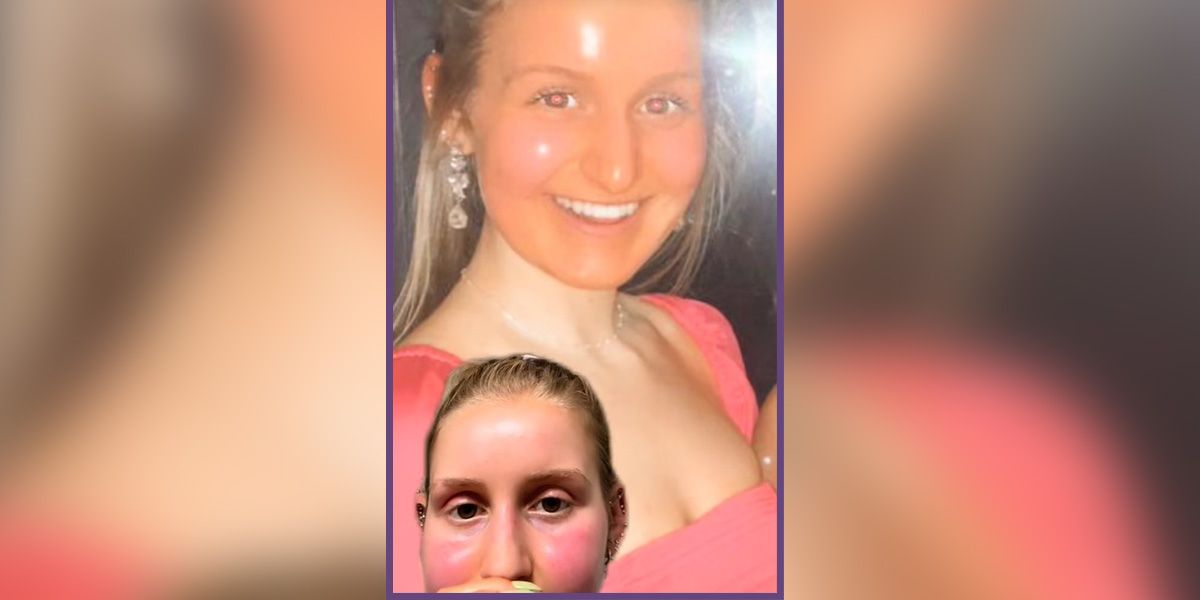 Interessanterweise änderte sich Dena Rendalls Hautfarbe nur im Gesicht, jedoch nicht an Hals oder Dekolleté. (Bild)