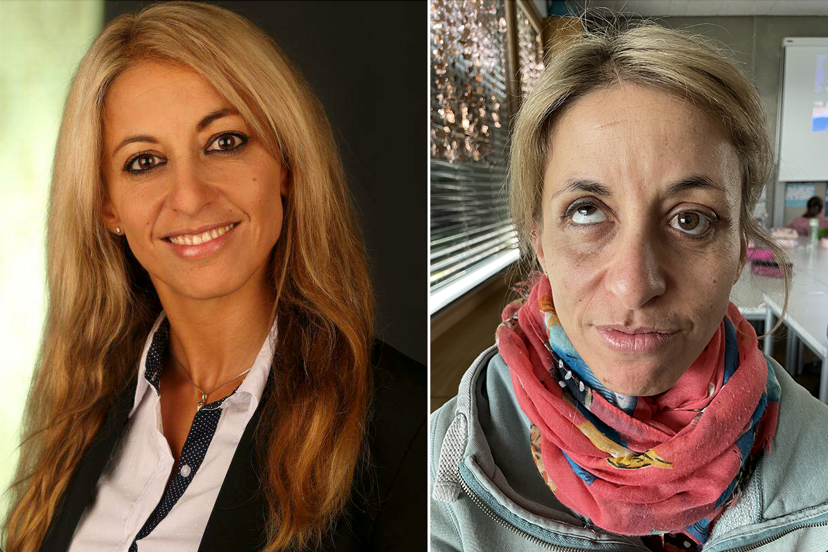 Elisabeth Rainer vor – und nach den Eingriffen.