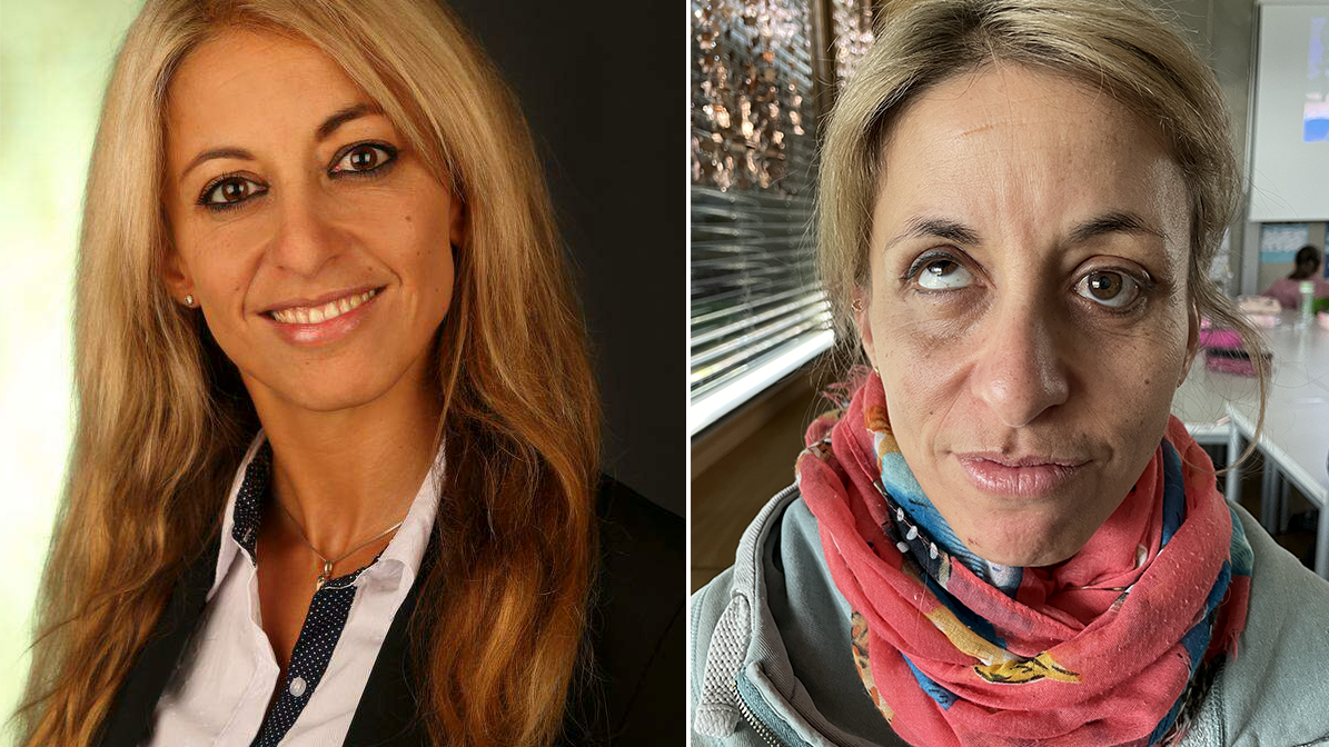 Frau nach Pfusch-OPs: "Fühle mich entstellt"