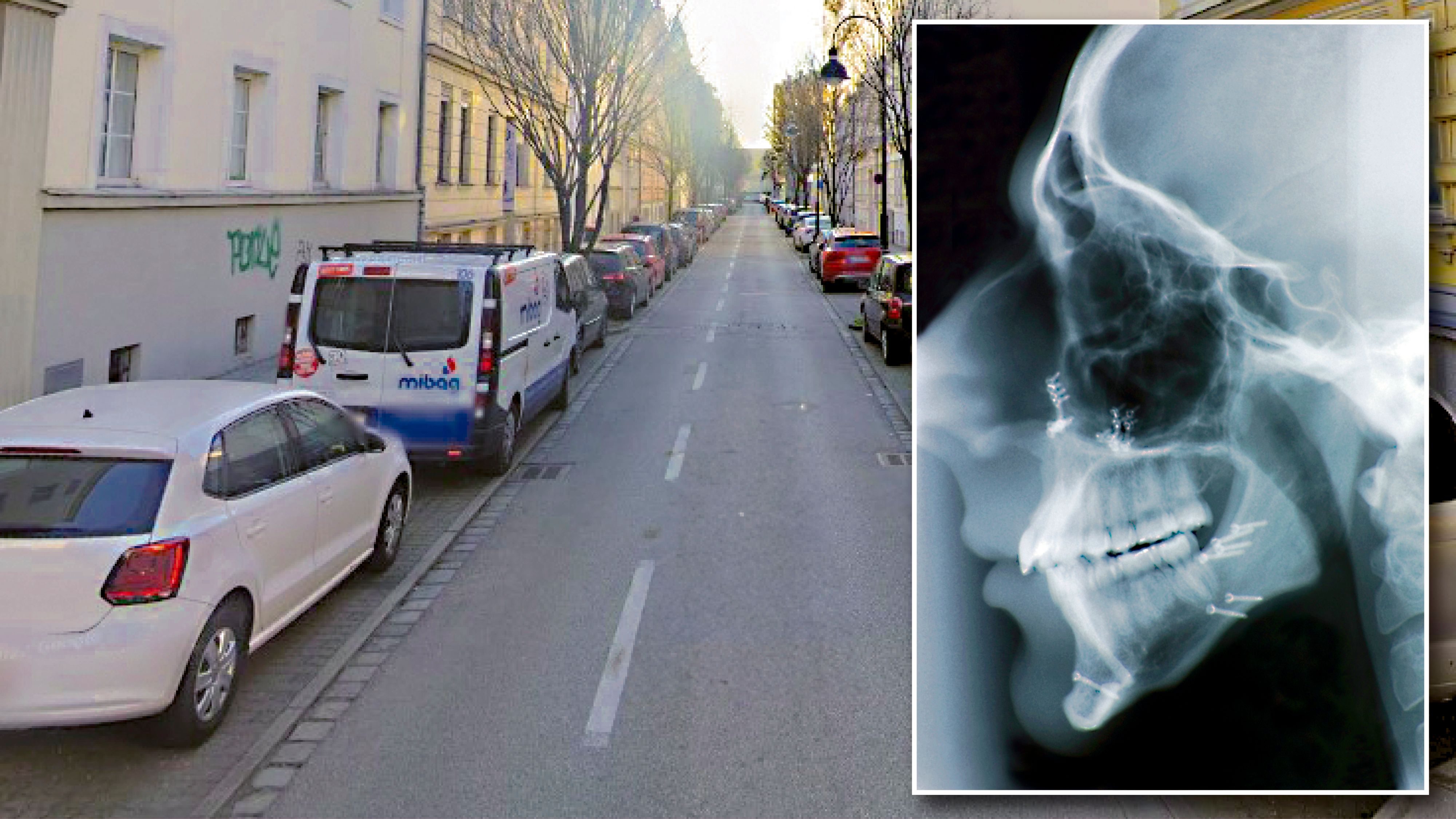 In der Starhembergstraße in Linz wurde einem jungen Mann der Kiefer gebrochen (Symbolfoto). Die Polizei fahndet nun nach den Tätern.