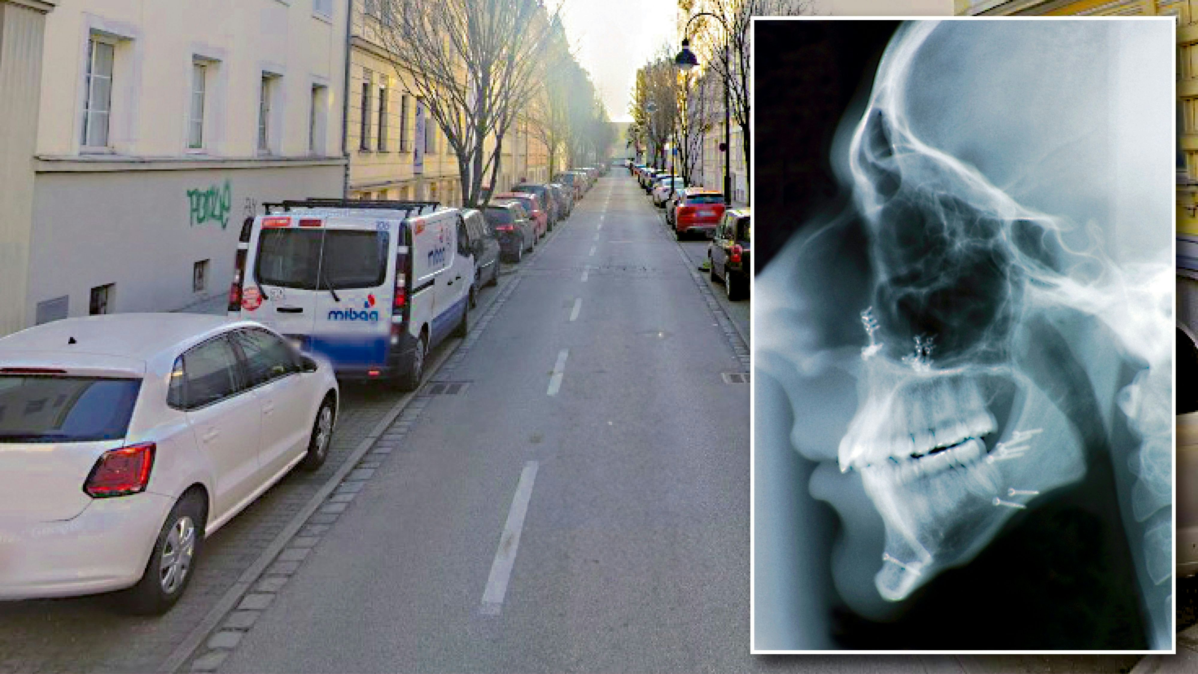 In der Starhembergstraße in Linz wurde einem jungen Mann der Kiefer gebrochen (Symbolfoto). Die Polizei fahndet nun nach den Tätern.