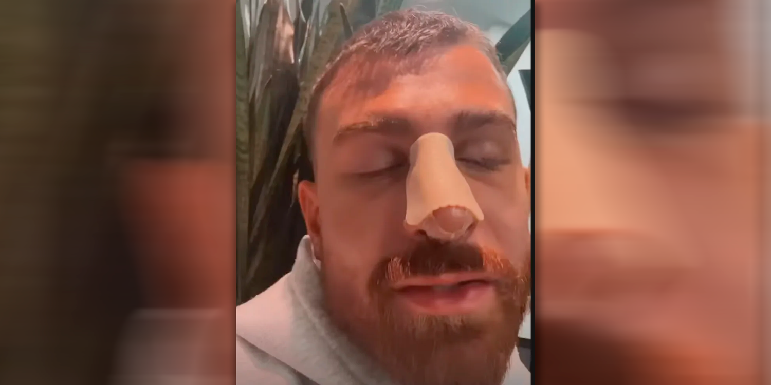 Gigi mit dickem Pflaster auf der Nase.