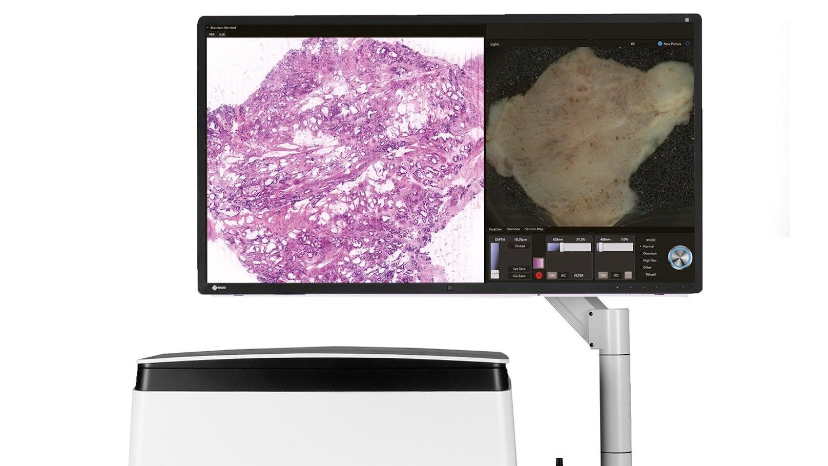 Meilenstein im Wiener AKH - VivaScope revolutioniert mit digital optischen Schnitten Krebsdiagnose 
