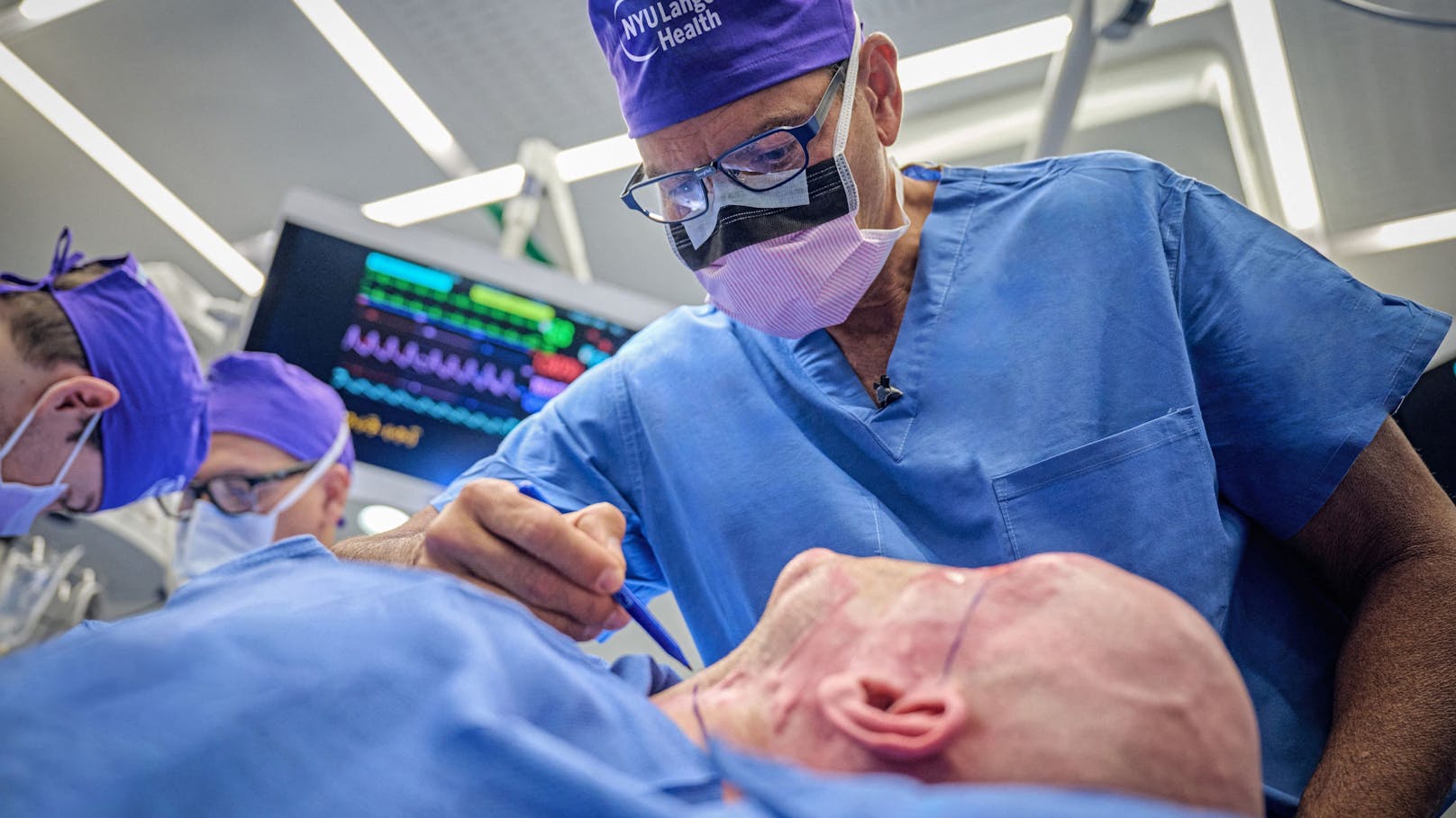 Ärzte transplantieren erstmals komplettes Auge