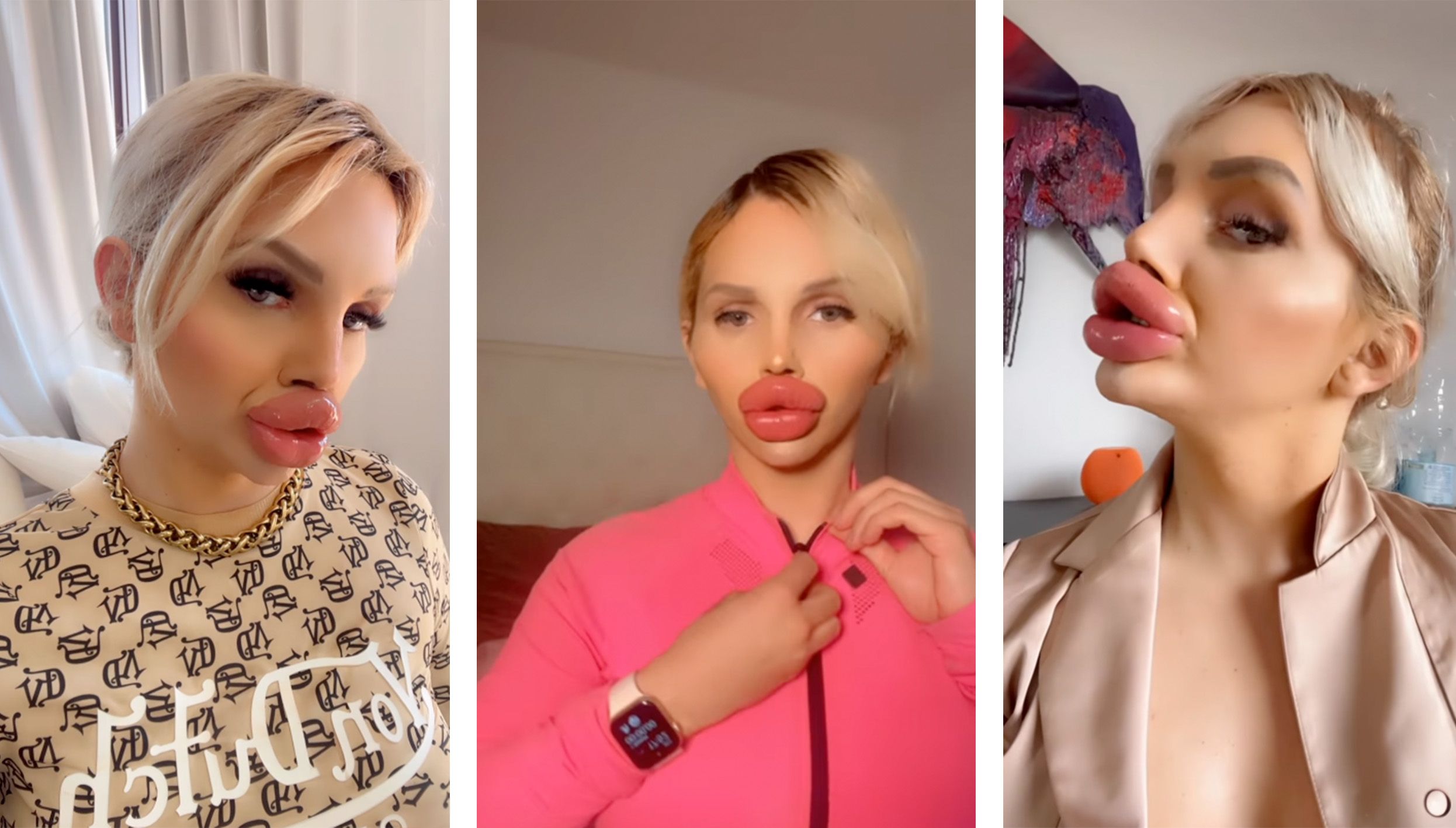 Trans-Influencerin @vienna.wuerstel sorgt mit ihren prallen Lippen für offene Münder.