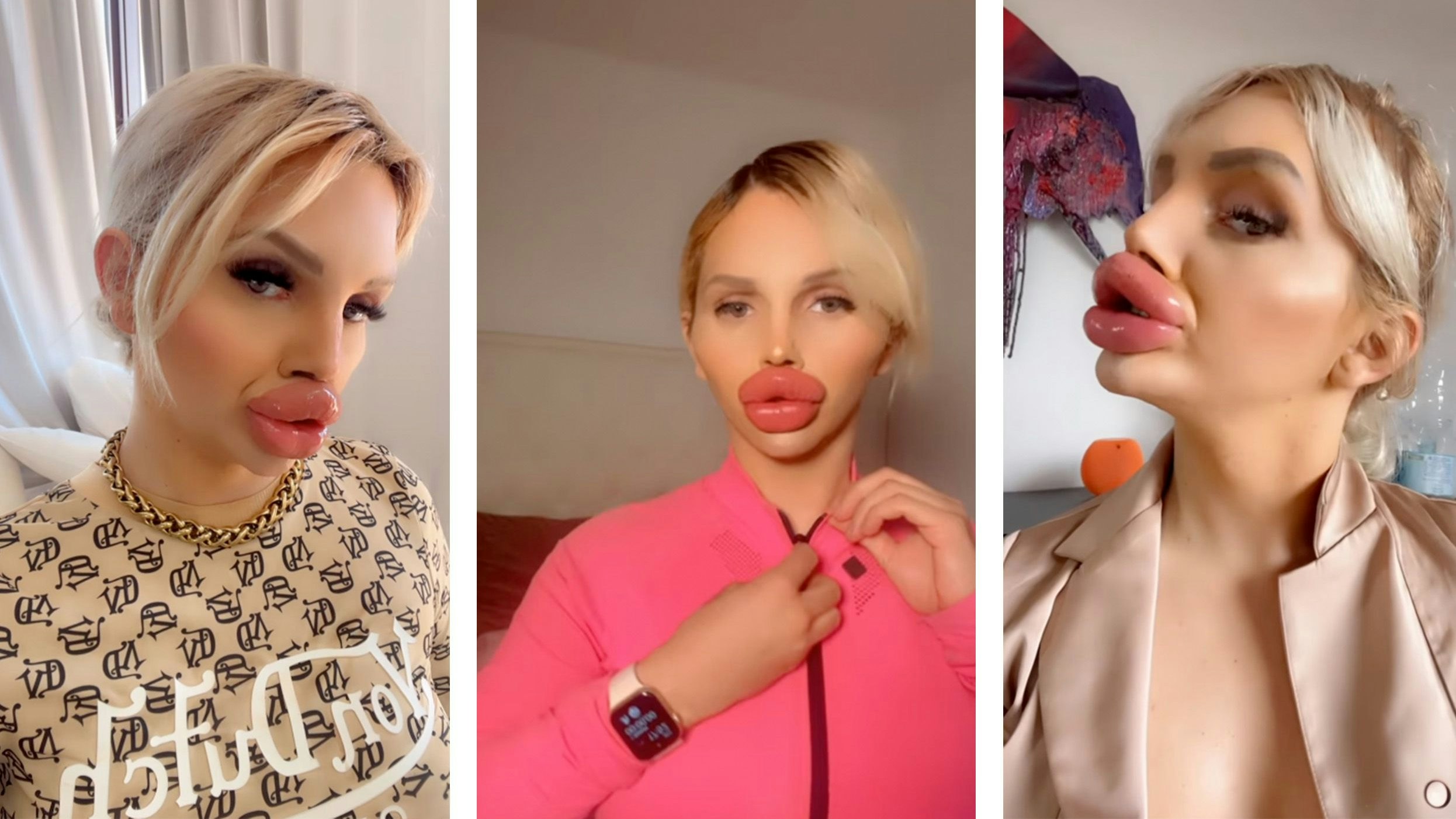 Trans-Influencerin @vienna.wuerstel sorgt mit ihren Lippen für offene Münder.