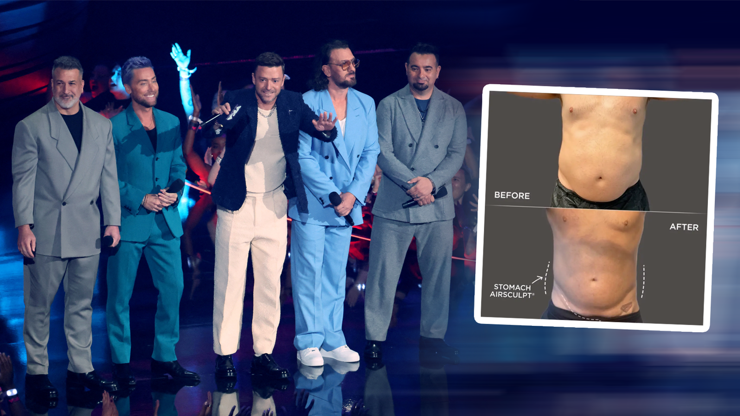 *NSYNC-Star Fatone erklärt, er war beim Beauty-Doc.