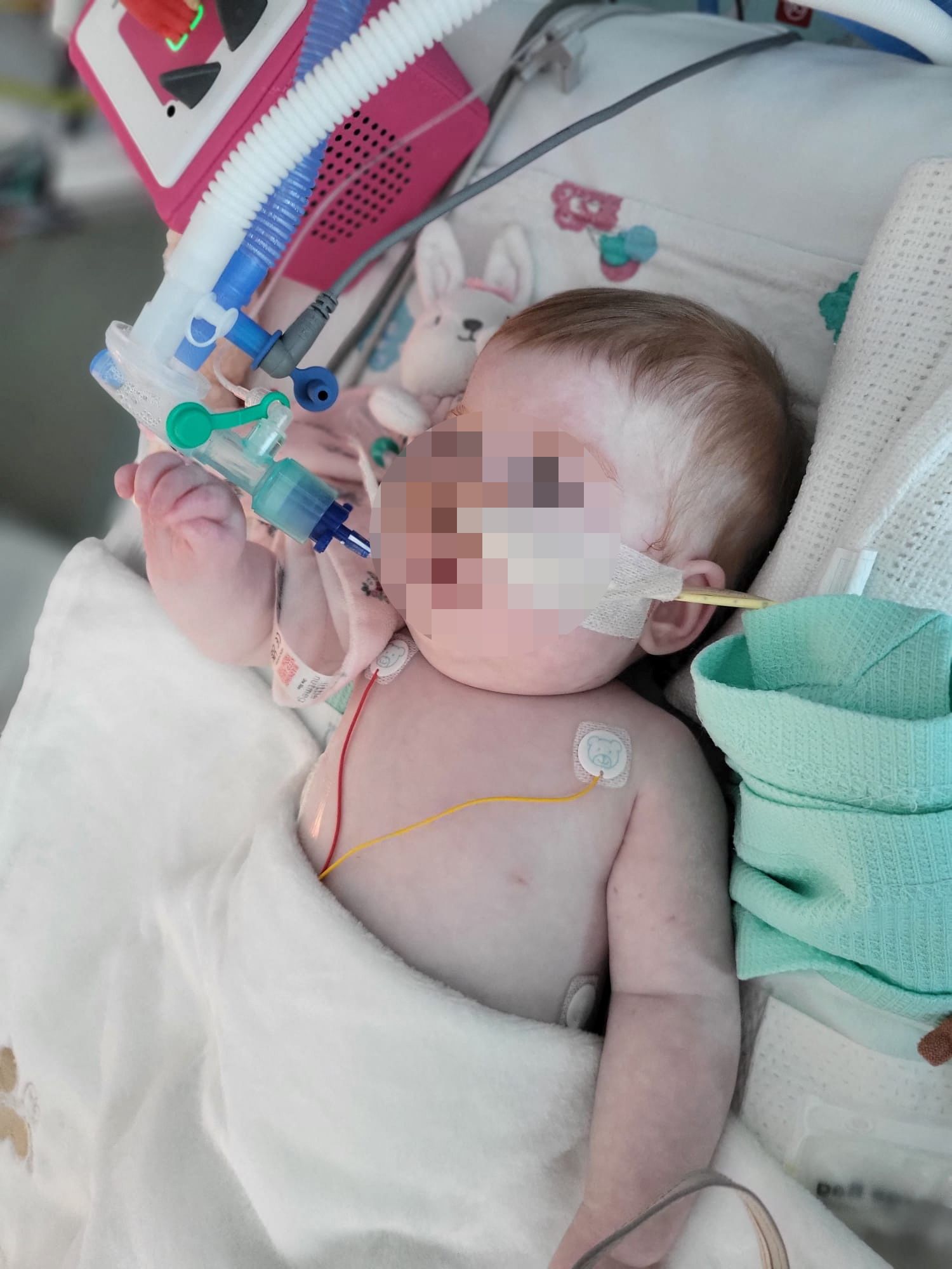 Indi Gregory ist tot: Das Kind starb an den Folgen einer unheilbaren Krankheit.