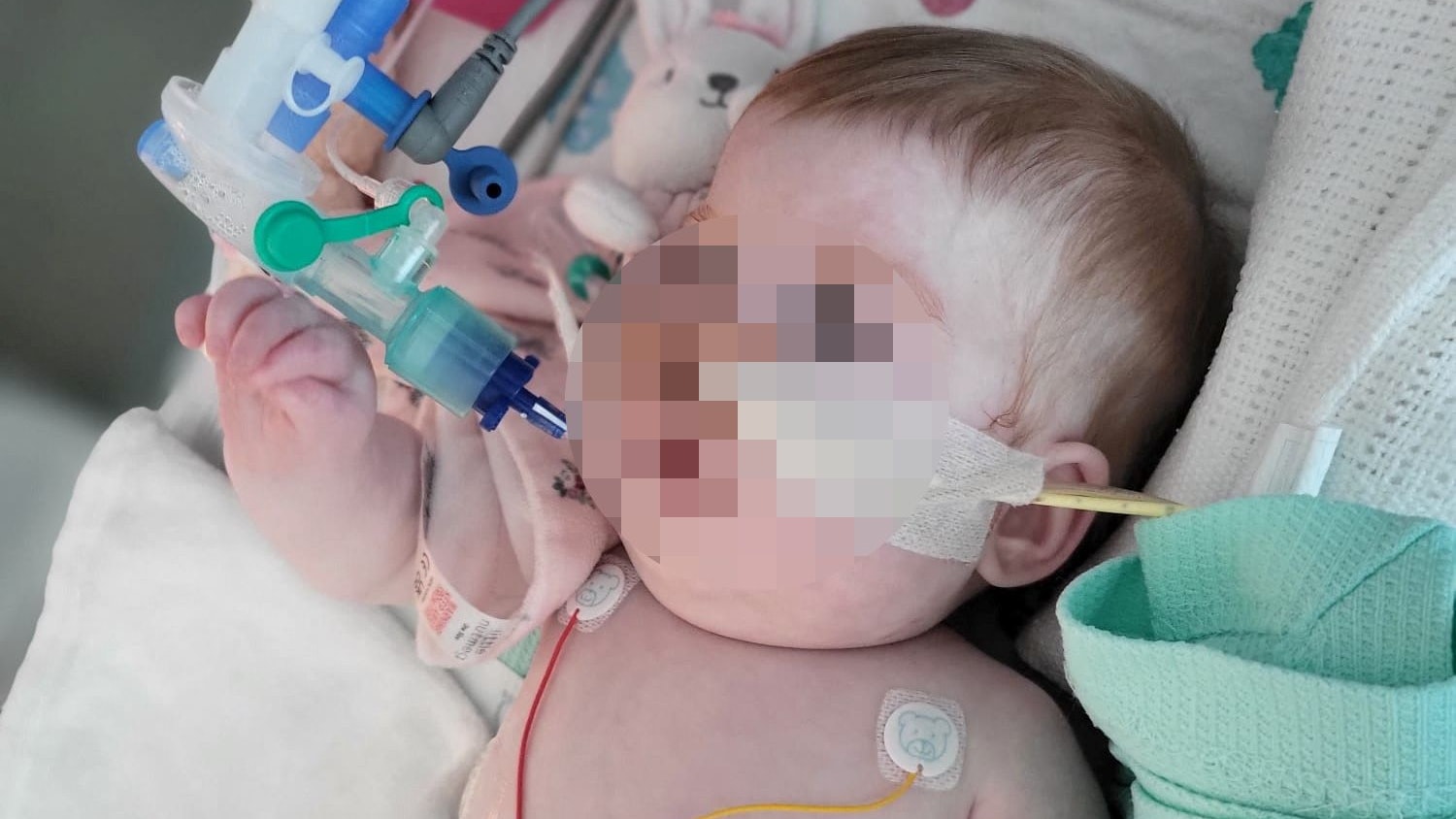 Indi Gregory ist tot: Das Kind starb an den Folgen einer unheilbaren Krankheit.