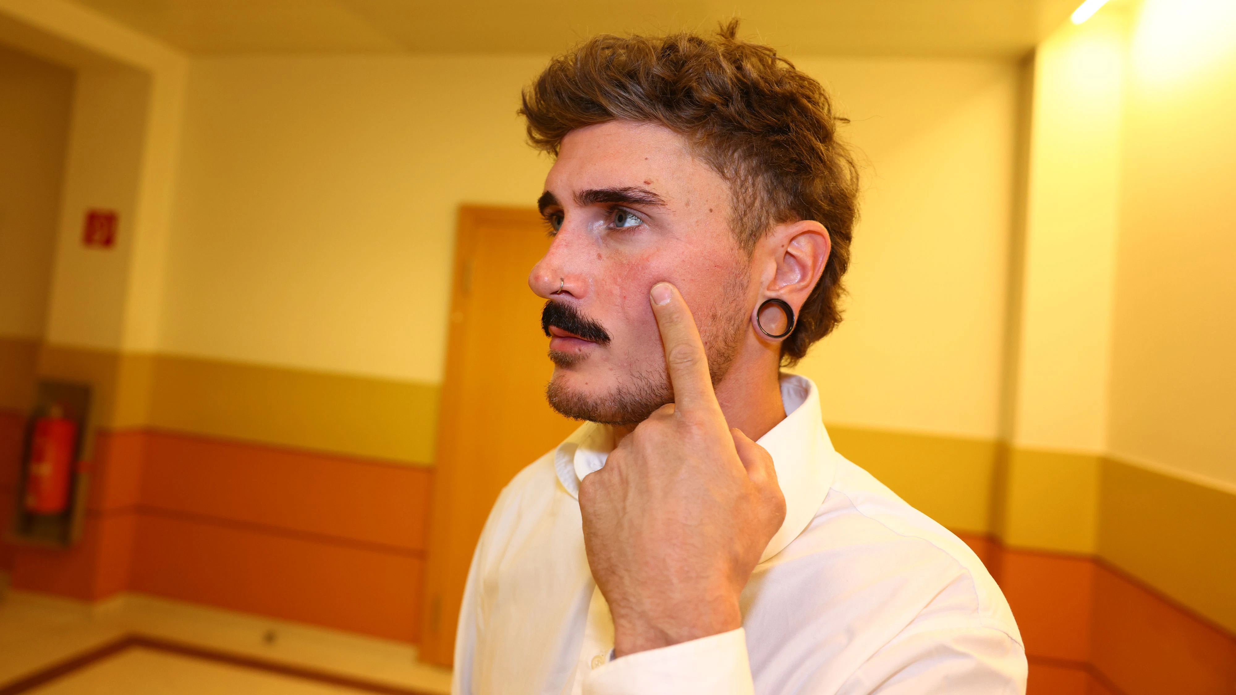 Mario M. (28) bekam das Glas ins Gesicht, zeigt seine Narbe.