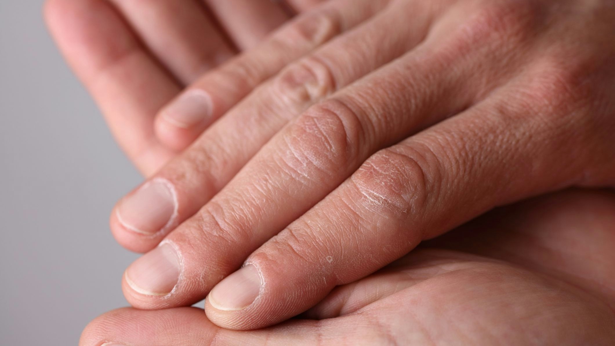 Die Bedürfnisse einer Haut müssen individuell angepasst werden.