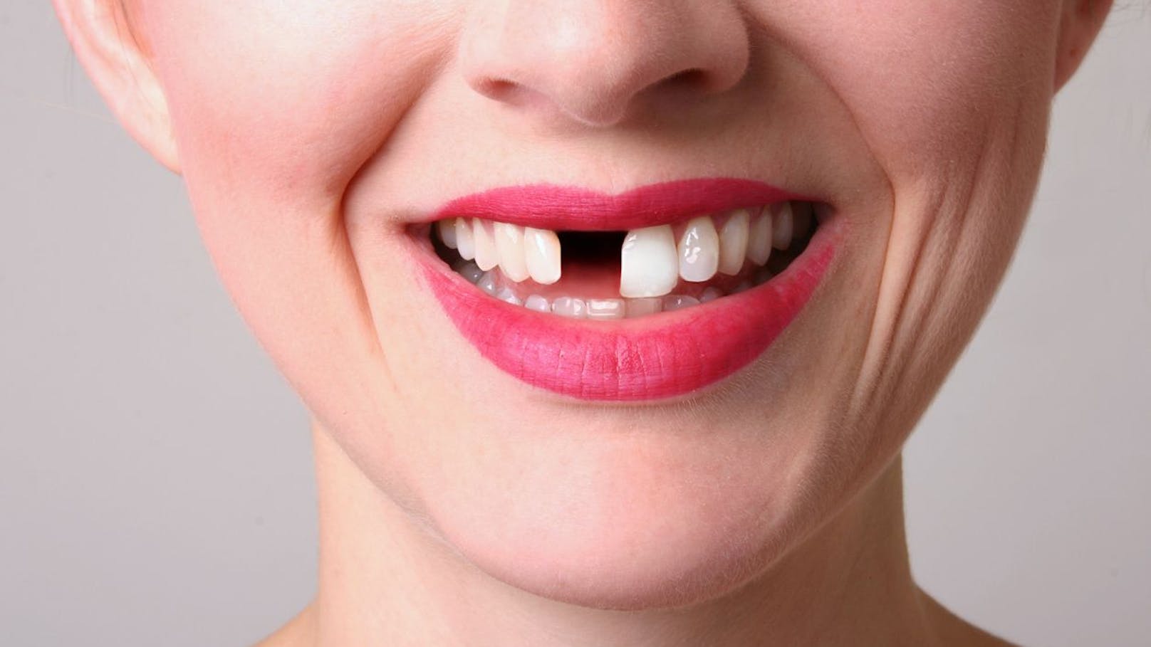 Warum träumen wir von ausfallenden Zähnen?