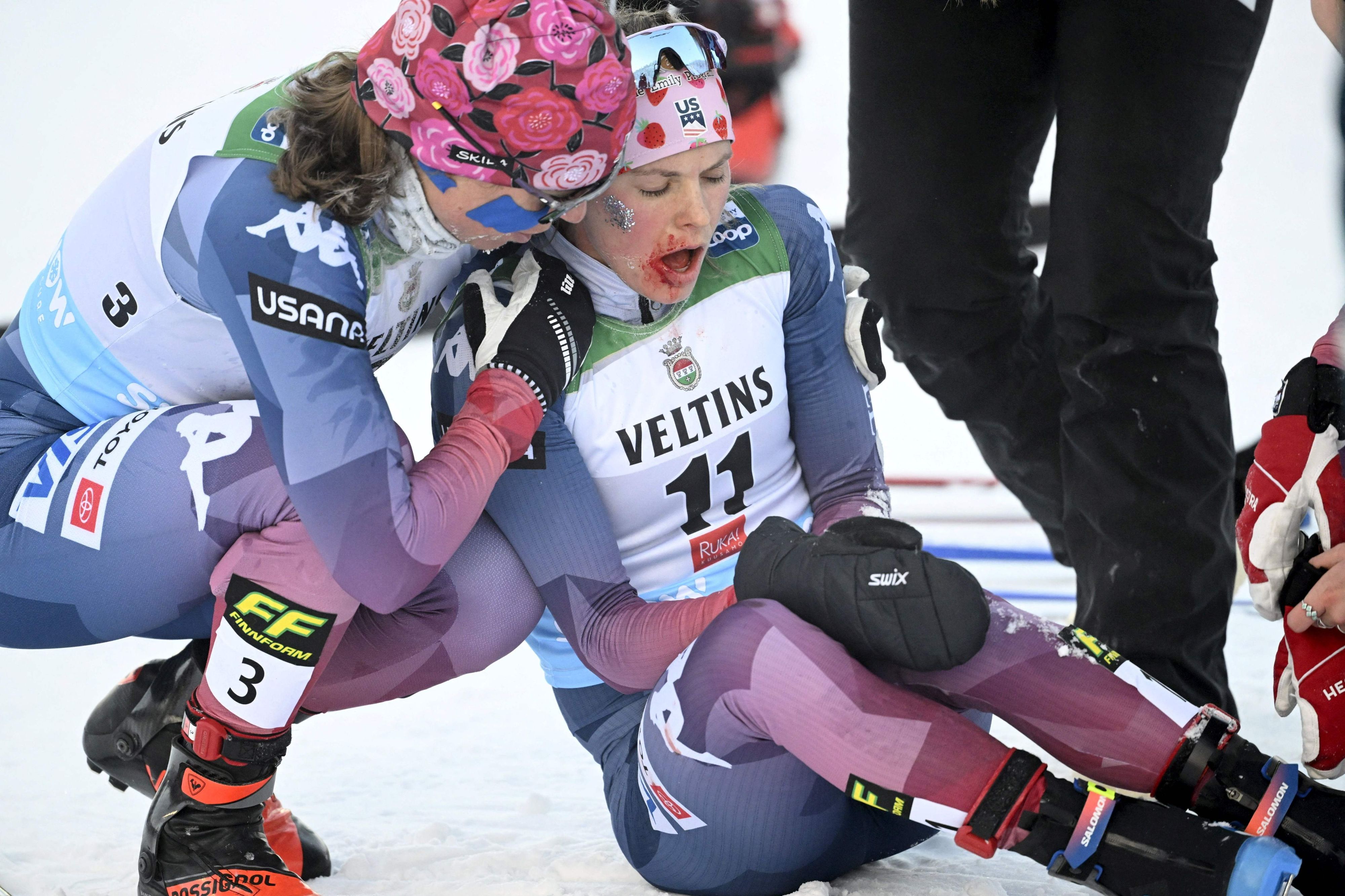 Jessie Diggins kam mit blutüberströmten Gesicht ins Ziel.