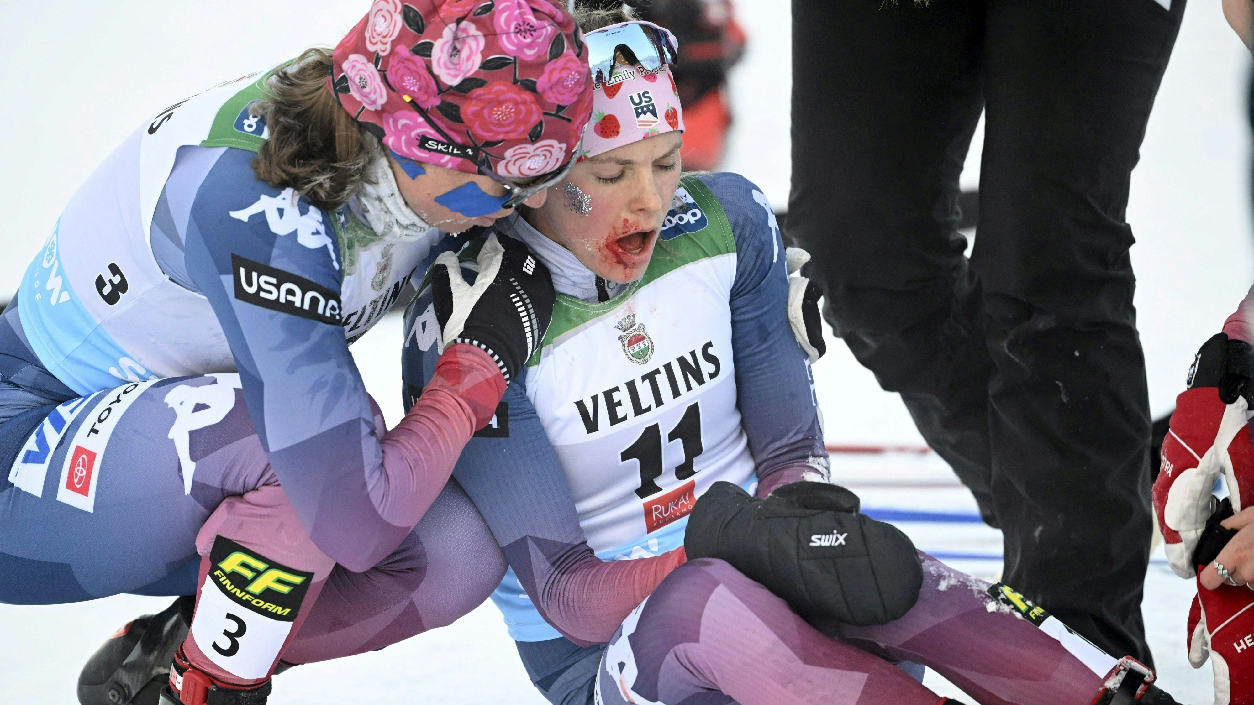 Jessie Diggins kam mit blutüberströmten Gesicht ins Ziel.