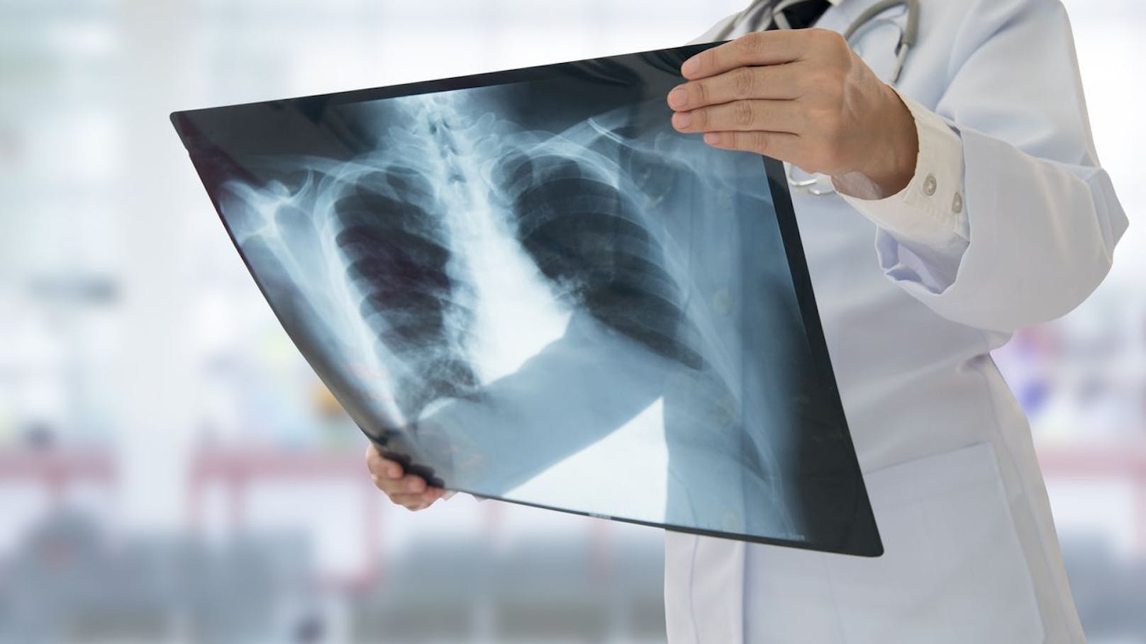 Ärzte röntgen Frau – und glauben nicht, was sie finden