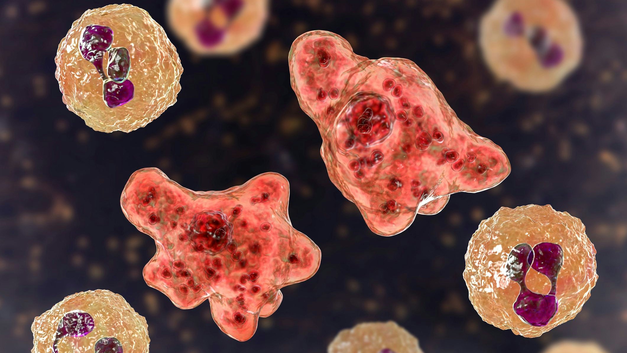 Heute.at - Immer mehr Todesfälle durch hirnfressende Amöbe