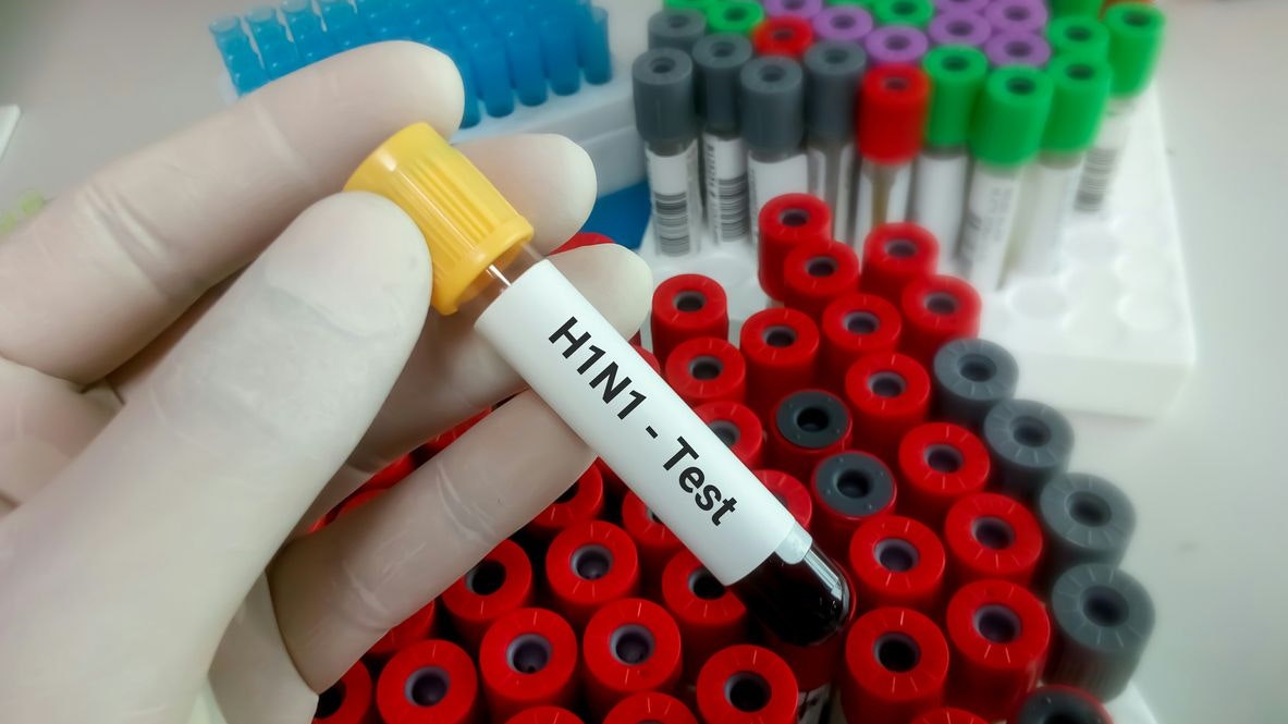 Der Zufallsfund bereitet Experten Sorgen. (Symbolbild)