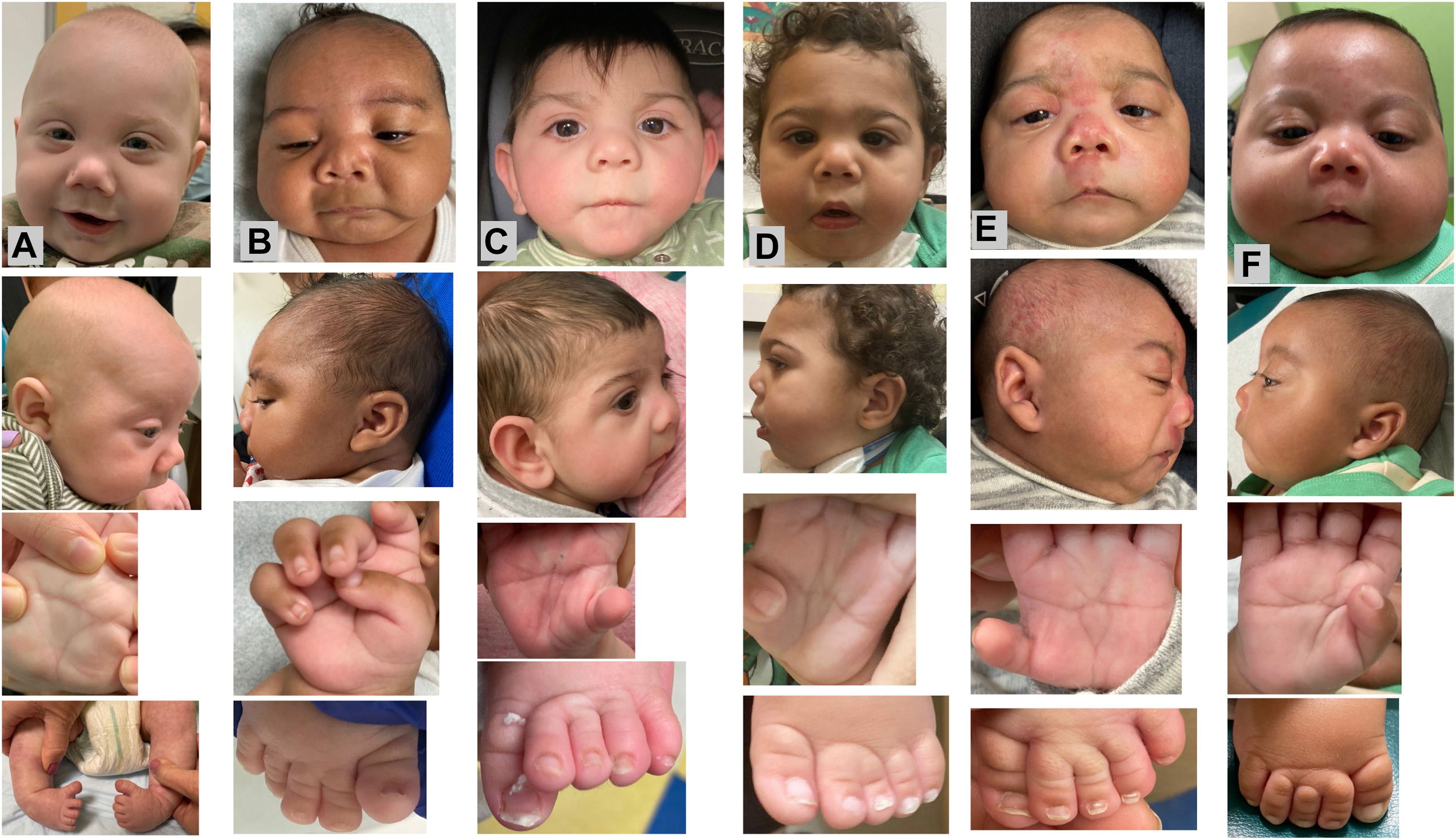 Die Liste an Fentanyl-bedingten Missbildungen ist lang.