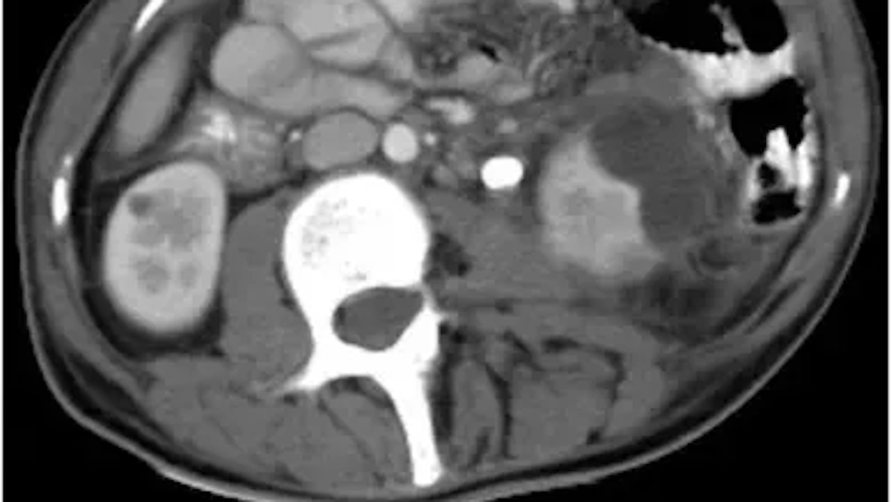 Heute.at - Großer Fremdkörper in Vagina: Frau muss in den Notfall