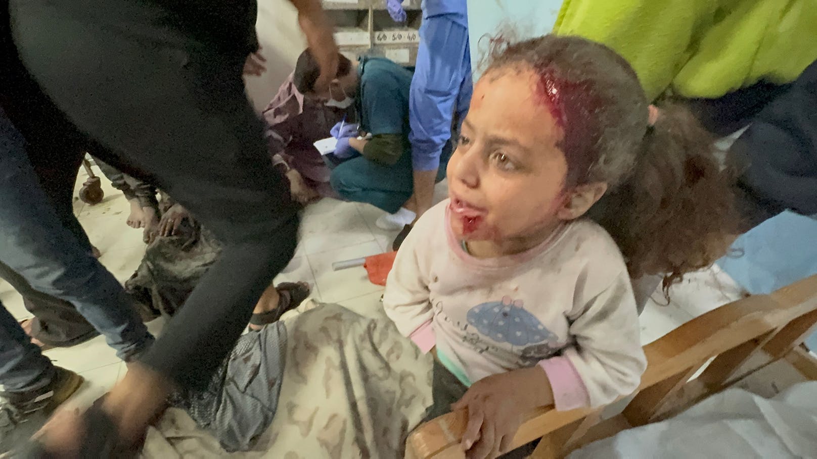 Ein palästinensisches Mädchen, das bei israelischen Angriffen verwundet wurde, wartet auf in einem Krankenhaus im südlichen Gazastreifen auf Hilfe.