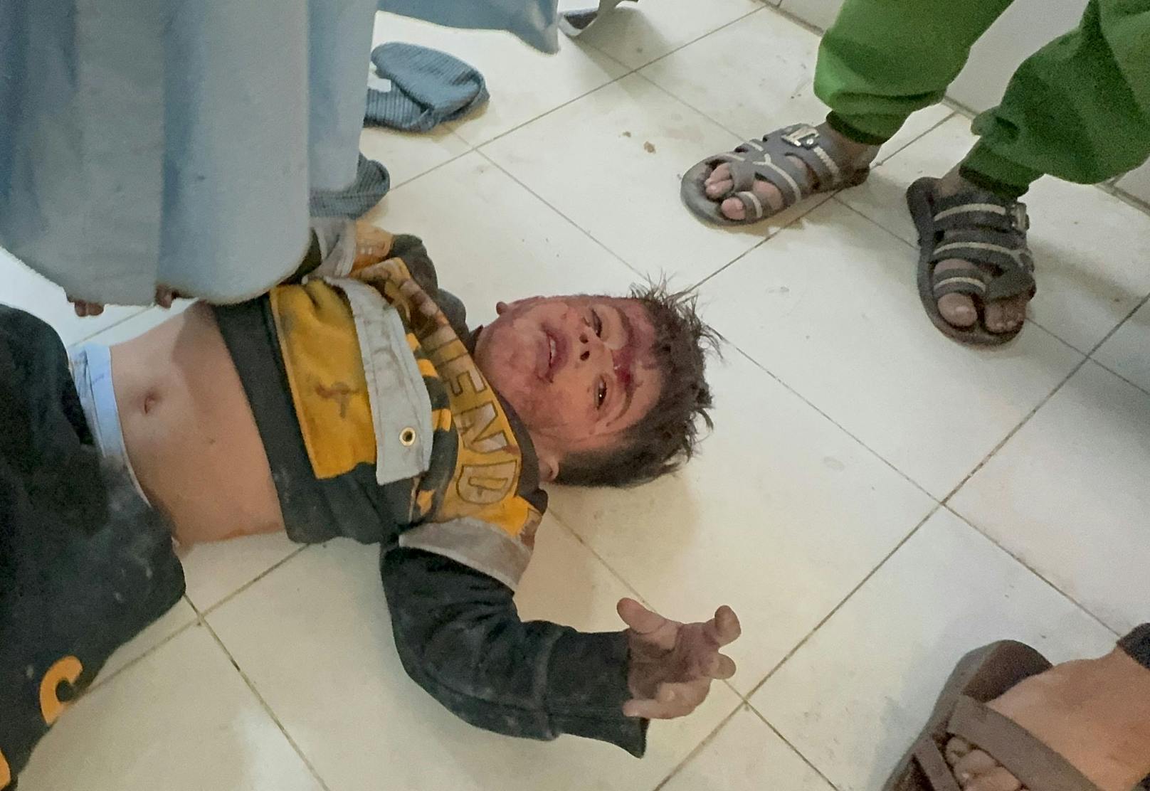 Ein palästinensisches Kind, das bei israelischen Angriffen verwundet wurde, warten in einem Krankenhaus auf Hilfe.