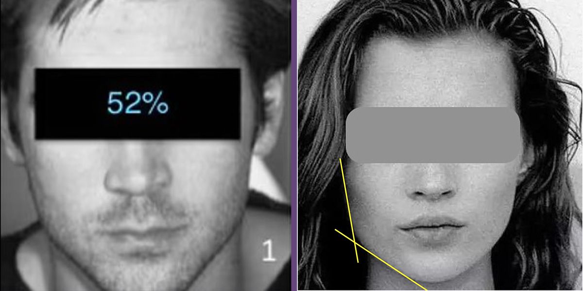 Die attraktivsten Kiefer hatten eine klar definierte V-Form.
