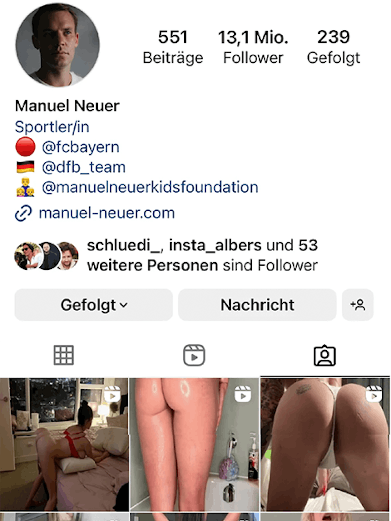 Die Seite von Manuel Neuer war betroffen.