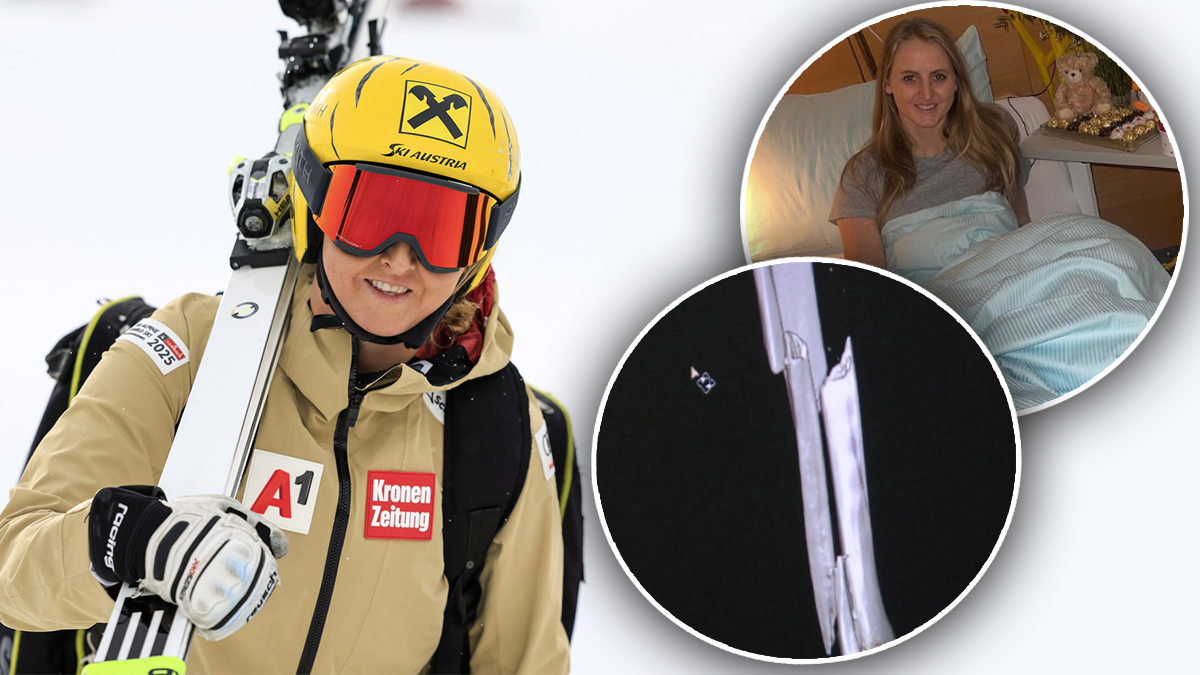 Heute.at - ÖSV-Star startet mit Metall im Bein: Treppen Problem