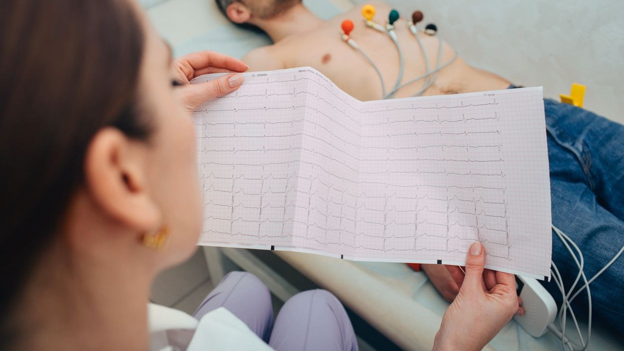 patient getting heart rate monitored with electrocardiogram equipment. cardiogram test, Close-up Of Ecg Report