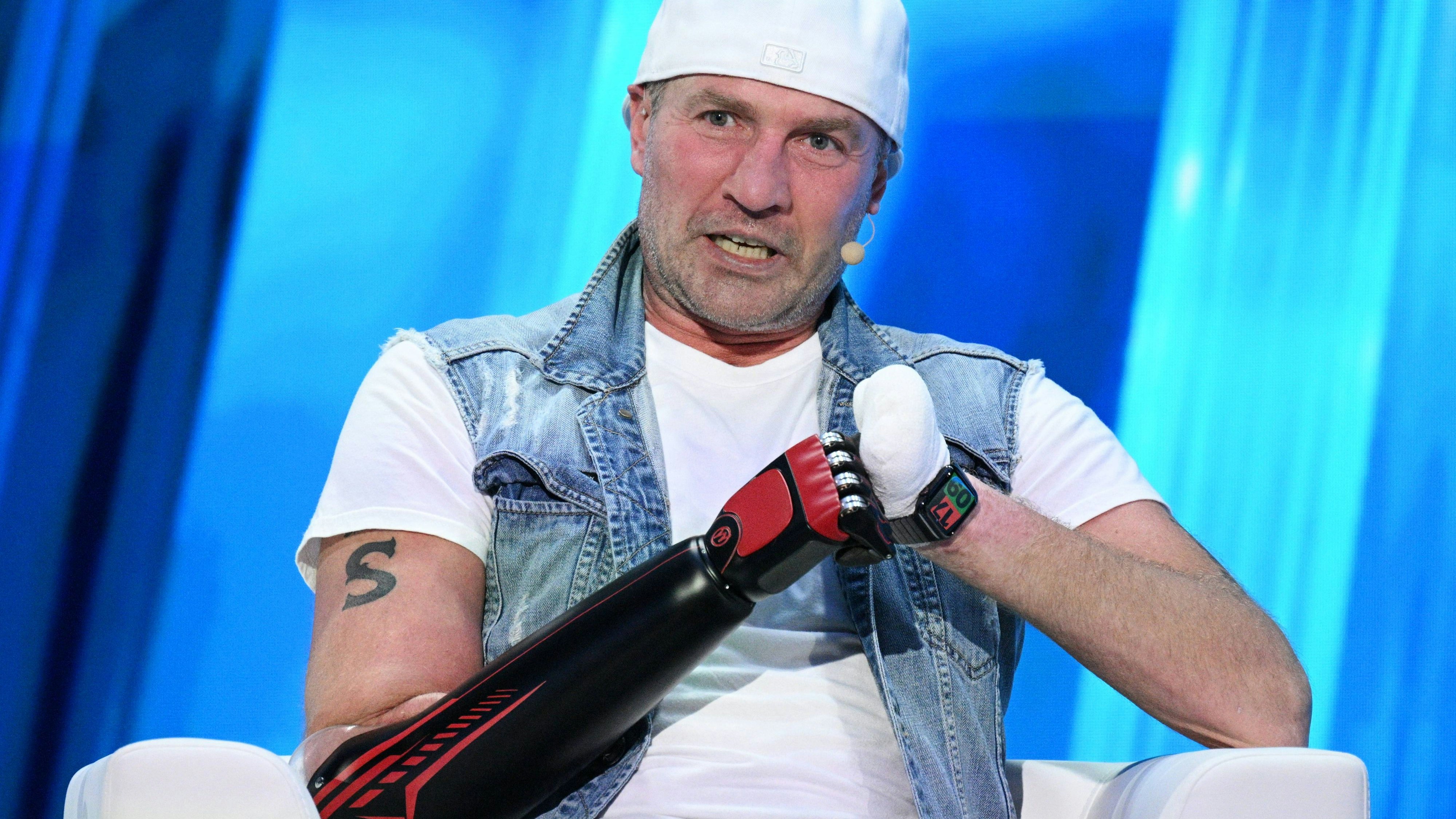 Ex-Eistänzer Roman Kostomarov wurden Arme und Beine amputiert.