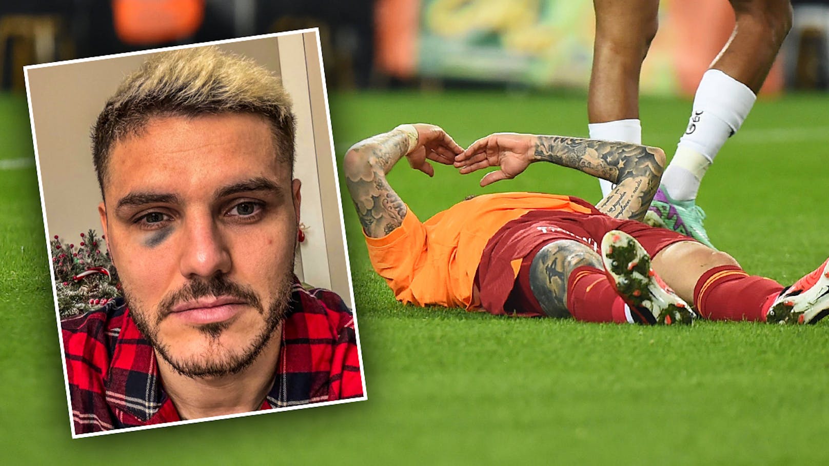 Derby-Prügel für Icardi! Blaues Auge zu Weihnachten