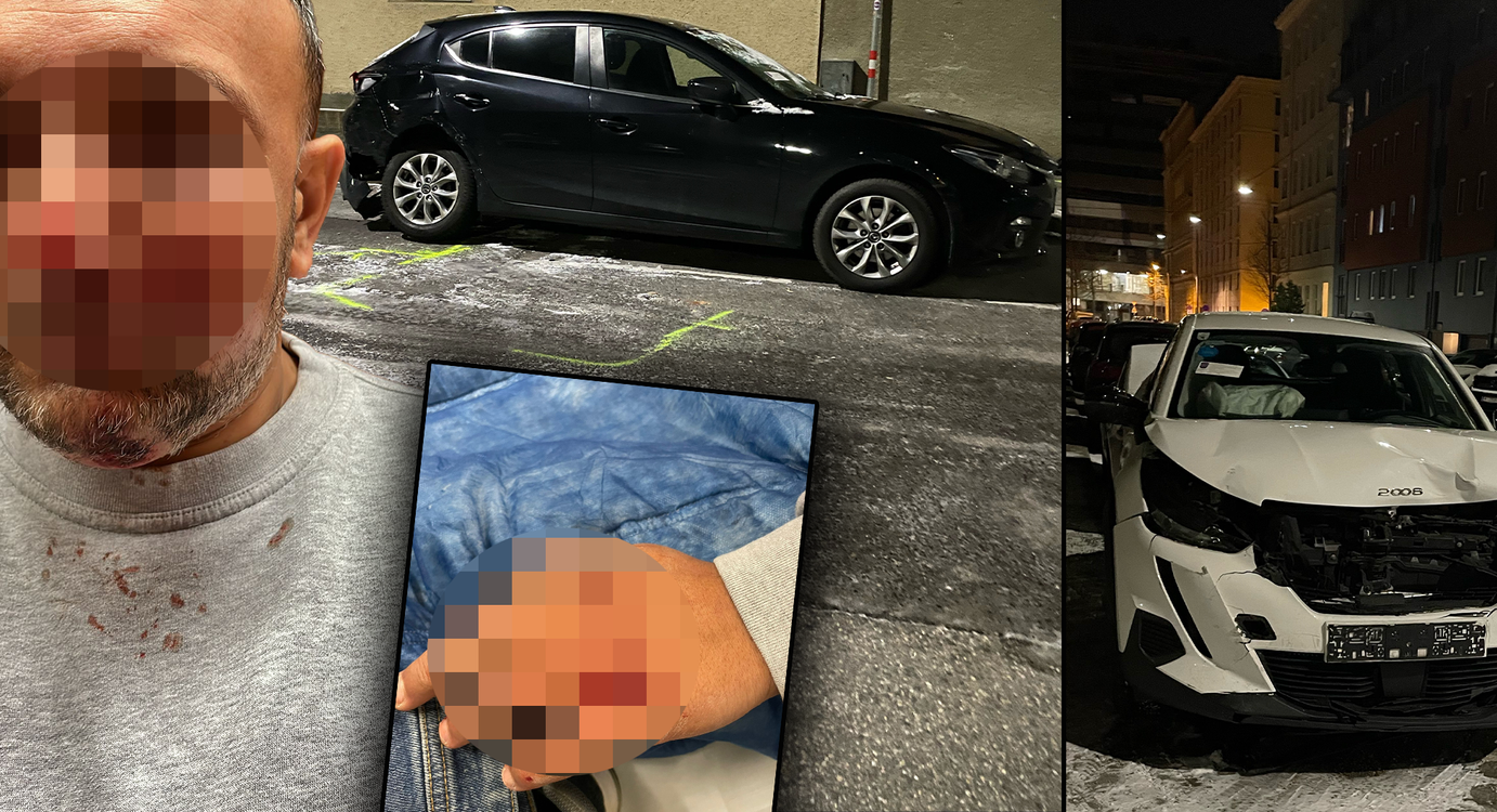 Nach einem Unfall mit Fahrerflucht musste ein Wiener hospitalisiert werden.